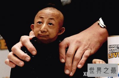 ​中国最矮的人何平平，一生仅74.6厘米(21岁离世)